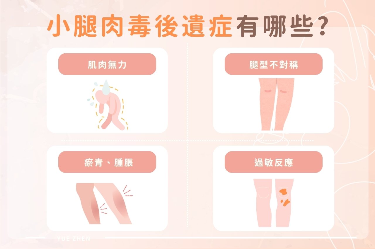 肉毒瘦小腿後遺症要注意! btx calf side effect img