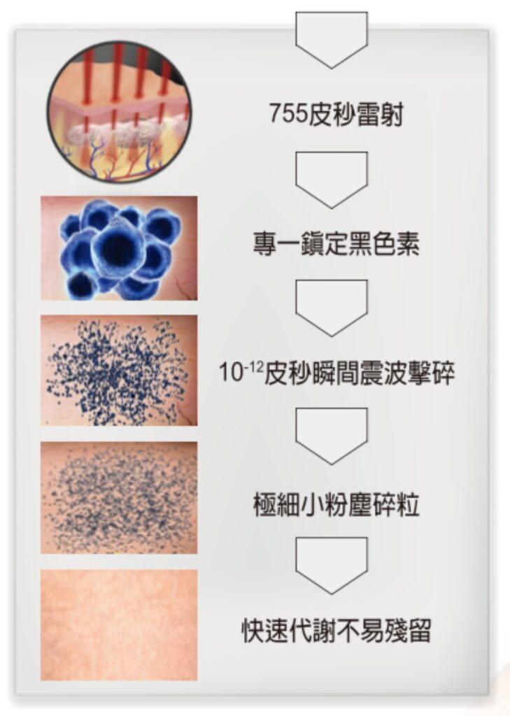 蜂巢皮秒是什麼?|高雄蜂巢皮秒價錢、功效、術後保養一次搞懂蜂巢皮秒會很痛嗎? 2 悅真醫美-蜂巢皮秒是什麼-03