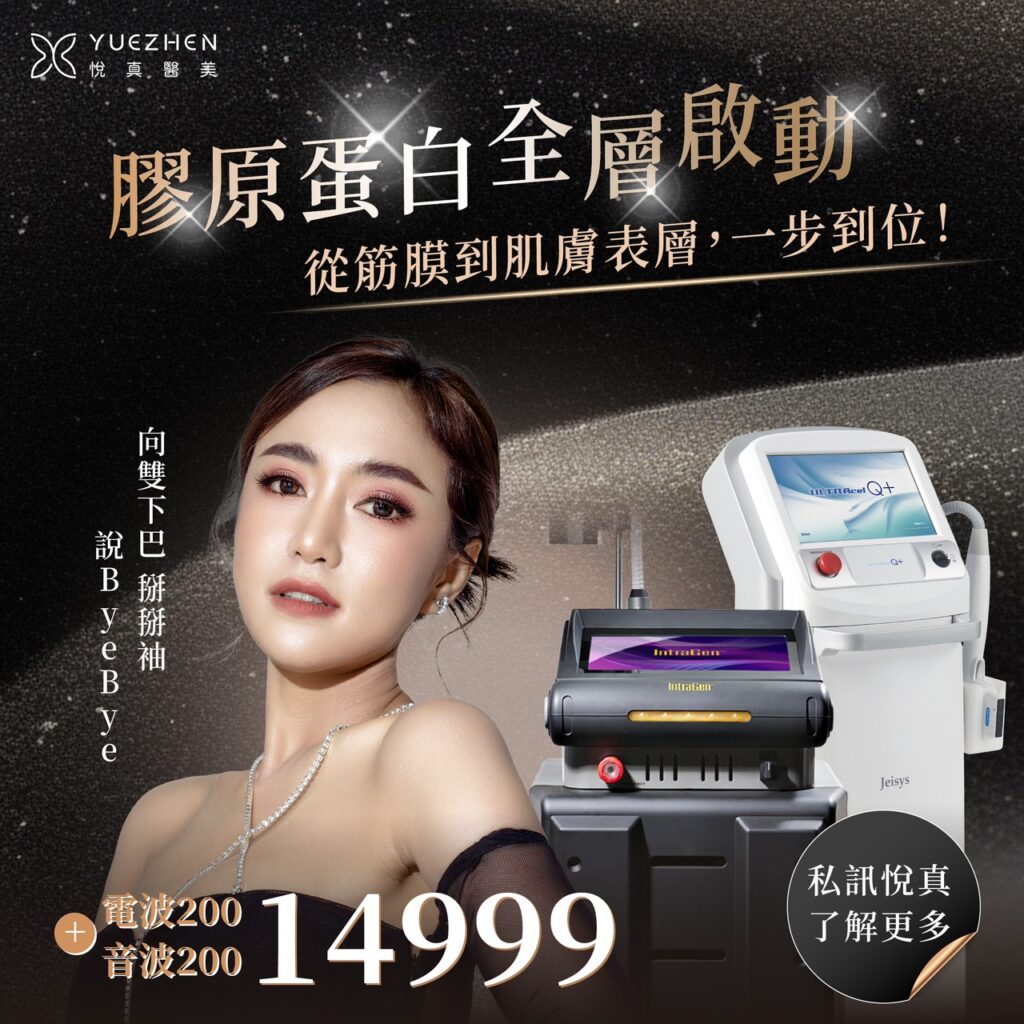 音波拉提有效嗎?音波要打幾條才夠?音波拉提效果、費用必看懶人包 2 音波+電波